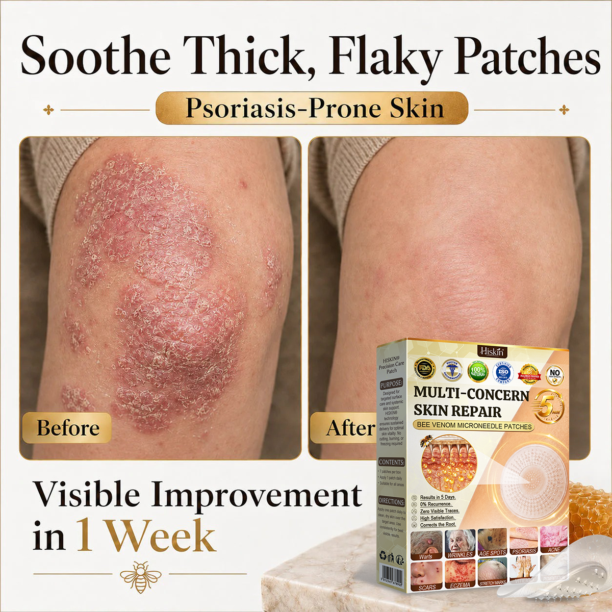 🐝🔥𝐇𝐈𝐒𝐊𝐈𝐍® 𝐀𝐝𝐯𝐚𝐧𝐜𝐞𝐝 𝐁𝐞𝐞 𝐕𝐞𝐧𝐨𝐦 𝐍𝐚𝐧𝐨 𝐌𝐢𝐜𝐫𝐨𝐧𝐞𝐞𝐝𝐥𝐞 𝐒𝐤𝐢𝐧 𝐑𝐞𝐧𝐞𝐰𝐚𝐥 𝐏𝐚𝐭𝐜𝐡 — 𝐀𝐧𝐭𝐢-𝐚𝐠𝐢𝐧𝐠, 𝐇𝐲𝐝𝐫𝐚𝐭𝐢𝐧𝐠, 𝐒𝐤𝐢𝐧 𝐑𝐞𝐩𝐚𝐢𝐫, 𝐄𝐯𝐞𝐧 𝐓𝐨𝐧𝐞, 𝐀𝐜𝐧𝐞 𝐚𝐧𝐝 𝐃𝐚𝐫𝐤 𝐒𝐩𝐨𝐭 𝐓𝐫𝐞𝐚𝐭𝐦𝐞𝐧𝐭, 𝐖𝐚𝐫𝐭 𝐚𝐧𝐝 𝐌𝐨𝐥𝐞 𝐑𝐞𝐦𝐨𝐯𝐚𝐥, 𝐏𝐬𝐨𝐫𝐢𝐚𝐬𝐢𝐬 𝐑𝐞𝐥𝐢𝐞𝐟