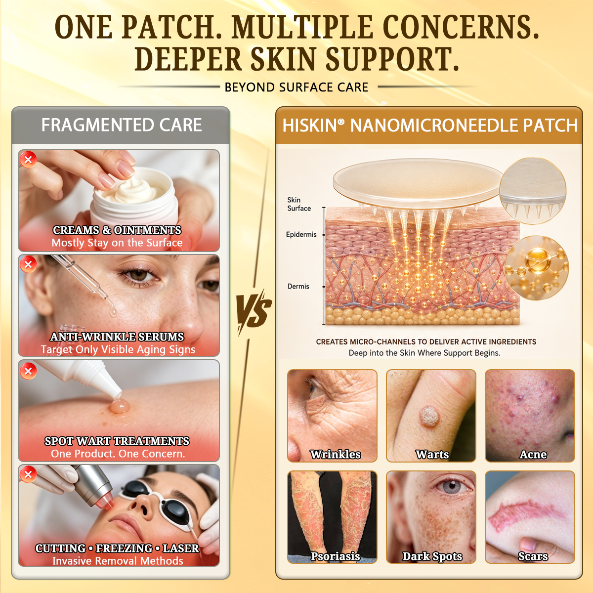 🐝🔥𝐇𝐈𝐒𝐊𝐈𝐍® 𝐀𝐝𝐯𝐚𝐧𝐜𝐞𝐝 𝐁𝐞𝐞 𝐕𝐞𝐧𝐨𝐦 𝐍𝐚𝐧𝐨 𝐌𝐢𝐜𝐫𝐨𝐧𝐞𝐞𝐝𝐥𝐞 𝐒𝐤𝐢𝐧 𝐑𝐞𝐧𝐞𝐰𝐚𝐥 𝐏𝐚𝐭𝐜𝐡 — 𝐀𝐧𝐭𝐢-𝐚𝐠𝐢𝐧𝐠, 𝐇𝐲𝐝𝐫𝐚𝐭𝐢𝐧𝐠, 𝐒𝐤𝐢𝐧 𝐑𝐞𝐩𝐚𝐢𝐫, 𝐄𝐯𝐞𝐧 𝐓𝐨𝐧𝐞, 𝐀𝐜𝐧𝐞 𝐚𝐧𝐝 𝐃𝐚𝐫𝐤 𝐒𝐩𝐨𝐭 𝐓𝐫𝐞𝐚𝐭𝐦𝐞𝐧𝐭, 𝐖𝐚𝐫𝐭 𝐚𝐧𝐝 𝐌𝐨𝐥𝐞 𝐑𝐞𝐦𝐨𝐯𝐚𝐥, 𝐏𝐬𝐨𝐫𝐢𝐚𝐬𝐢𝐬 𝐑𝐞𝐥𝐢𝐞𝐟