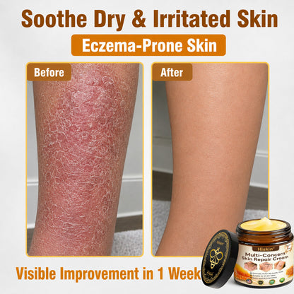 ✨🐝𝐇𝐈𝐒𝐊𝐈𝐍® 𝐌𝐮𝐥𝐭𝐢-𝐂𝐨𝐧𝐜𝐞𝐫𝐧 𝐒𝐤𝐢𝐧 𝐑𝐞𝐩𝐚𝐢𝐫 𝐂𝐫𝐞𝐚𝐦 (𝐎𝐧𝐞 𝐩𝐨𝐰𝐞𝐫𝐟𝐮𝐥 𝐜𝐫𝐞𝐚𝐦 𝐭𝐨 𝐫𝐞𝐩𝐚𝐢𝐫 𝐢𝐧𝐟𝐥𝐚𝐦𝐦𝐚𝐭𝐢𝐨𝐧, 𝐝𝐫𝐲𝐧𝐞𝐬𝐬, 𝐚𝐠𝐢𝐧𝐠, 𝐩𝐢𝐠𝐦𝐞𝐧𝐭𝐚𝐭𝐢𝐨𝐧, 𝐚𝐧𝐝 𝐯𝐢𝐬𝐢𝐛𝐥𝐞 𝐬𝐤𝐢𝐧 𝐝𝐚𝐦𝐚𝐠𝐞.)