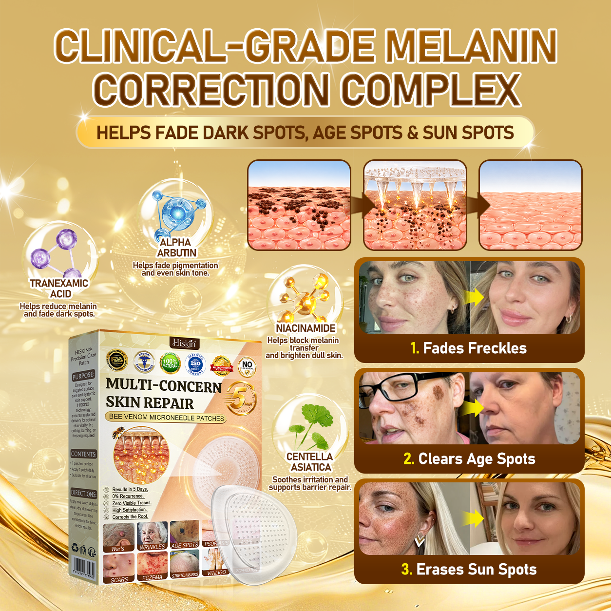🐝🔥𝐇𝐈𝐒𝐊𝐈𝐍® 𝐀𝐝𝐯𝐚𝐧𝐜𝐞𝐝 𝐁𝐞𝐞 𝐕𝐞𝐧𝐨𝐦 𝐍𝐚𝐧𝐨 𝐌𝐢𝐜𝐫𝐨𝐧𝐞𝐞𝐝𝐥𝐞 𝐒𝐤𝐢𝐧 𝐑𝐞𝐧𝐞𝐰𝐚𝐥 𝐏𝐚𝐭𝐜𝐡 — 𝐀𝐧𝐭𝐢-𝐚𝐠𝐢𝐧𝐠, 𝐇𝐲𝐝𝐫𝐚𝐭𝐢𝐧𝐠, 𝐒𝐤𝐢𝐧 𝐑𝐞𝐩𝐚𝐢𝐫, 𝐄𝐯𝐞𝐧 𝐓𝐨𝐧𝐞, 𝐀𝐜𝐧𝐞 𝐚𝐧𝐝 𝐃𝐚𝐫𝐤 𝐒𝐩𝐨𝐭 𝐓𝐫𝐞𝐚𝐭𝐦𝐞𝐧𝐭, 𝐖𝐚𝐫𝐭 𝐚𝐧𝐝 𝐌𝐨𝐥𝐞 𝐑𝐞𝐦𝐨𝐯𝐚𝐥, 𝐏𝐬𝐨𝐫𝐢𝐚𝐬𝐢𝐬 𝐑𝐞𝐥𝐢𝐞𝐟