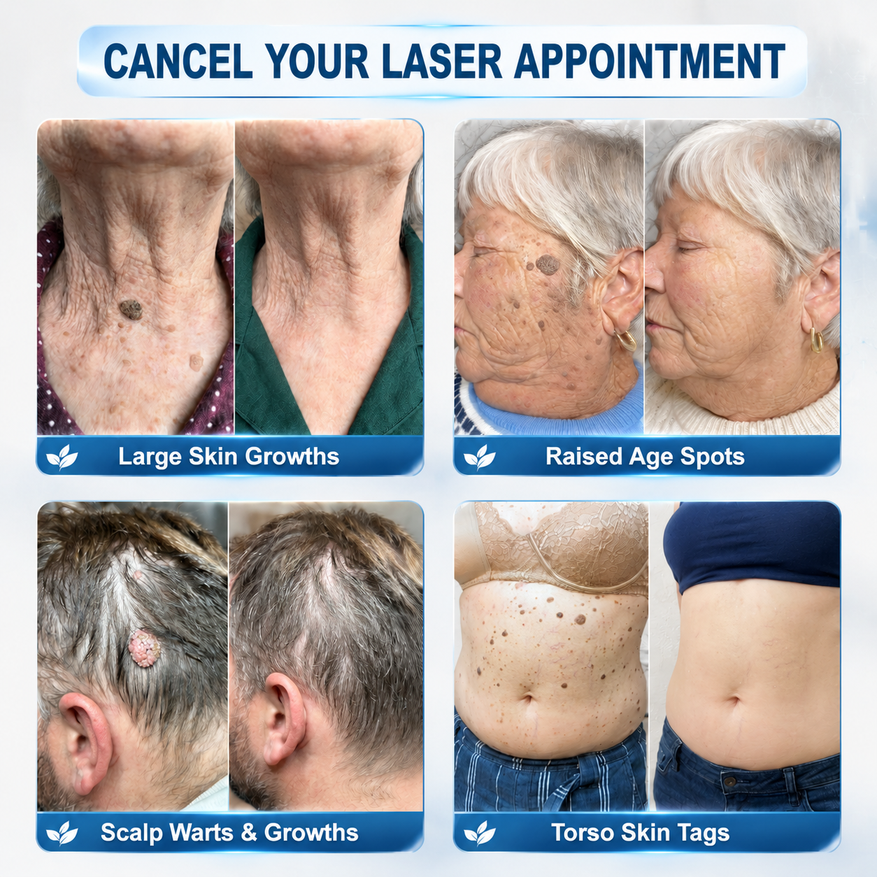 𝐎𝐟𝐟𝐢𝐜𝐢𝐚𝐥 𝐁𝐫𝐚𝐧𝐝 𝐒𝐭𝐨𝐫𝐞 |✅💎𝐇𝒊𝗦𝙆𝒊𝗡® 7-𝐷𝑎𝑦 𝗧𝐚𝐠 & 𝗦𝗽𝐨𝐭 𝐄𝐫𝒂𝒔𝒆𝒓(Zero Pain, Zero 𝐒𝐜𝐚𝒓𝒔 Rollerball)