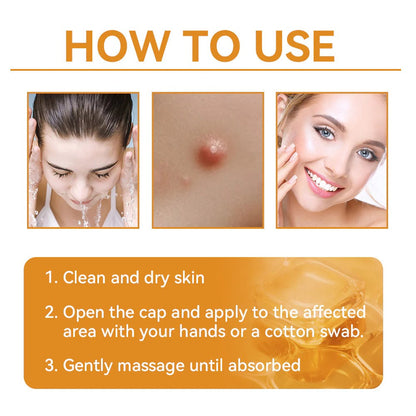 ✨🐝𝐇𝐈𝐒𝐊𝐈𝐍® 𝐌𝐮𝐥𝐭𝐢-𝐂𝐨𝐧𝐜𝐞𝐫𝐧 𝐒𝐤𝐢𝐧 𝐑𝐞𝐩𝐚𝐢𝐫 𝐂𝐫𝐞𝐚𝐦 (𝐎𝐧𝐞 𝐩𝐨𝐰𝐞𝐫𝐟𝐮𝐥 𝐜𝐫𝐞𝐚𝐦 𝐭𝐨 𝐫𝐞𝐩𝐚𝐢𝐫 𝐢𝐧𝐟𝐥𝐚𝐦𝐦𝐚𝐭𝐢𝐨𝐧, 𝐝𝐫𝐲𝐧𝐞𝐬𝐬, 𝐚𝐠𝐢𝐧𝐠, 𝐩𝐢𝐠𝐦𝐞𝐧𝐭𝐚𝐭𝐢𝐨𝐧, 𝐚𝐧𝐝 𝐯𝐢𝐬𝐢𝐛𝐥𝐞 𝐬𝐤𝐢𝐧 𝐝𝐚𝐦𝐚𝐠𝐞.)