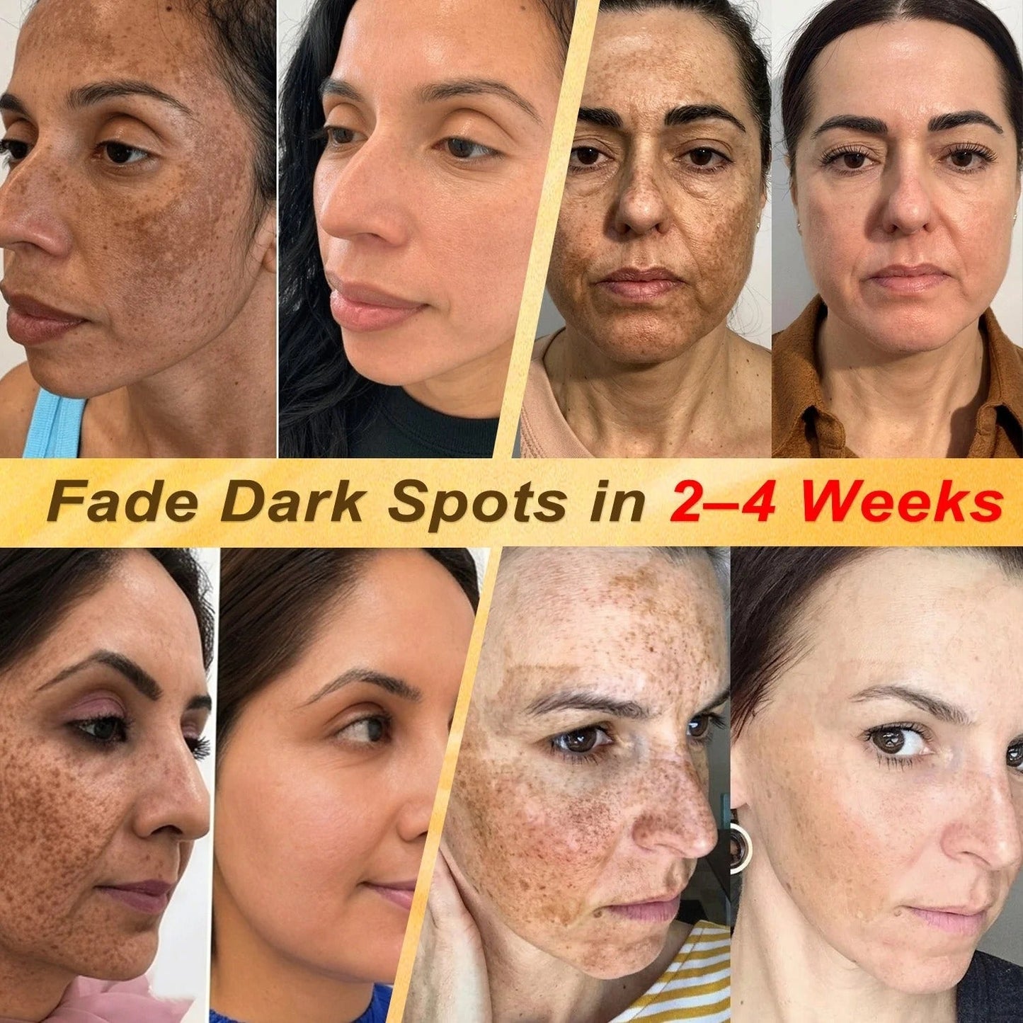 🎉 LUCKY YOU! Your Exclusive 80% OFF Skin Upgrade Is Ready! HISKIN® Repair Microneedle Patches | Just Apply & Go For Easy Skin Nourishment, Hydration & Smoother-Looking Skin + 180-Day Guarantee